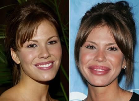 Nikki Cox Autors: Khalifa 12 Sliktākās plastiskās operācijas