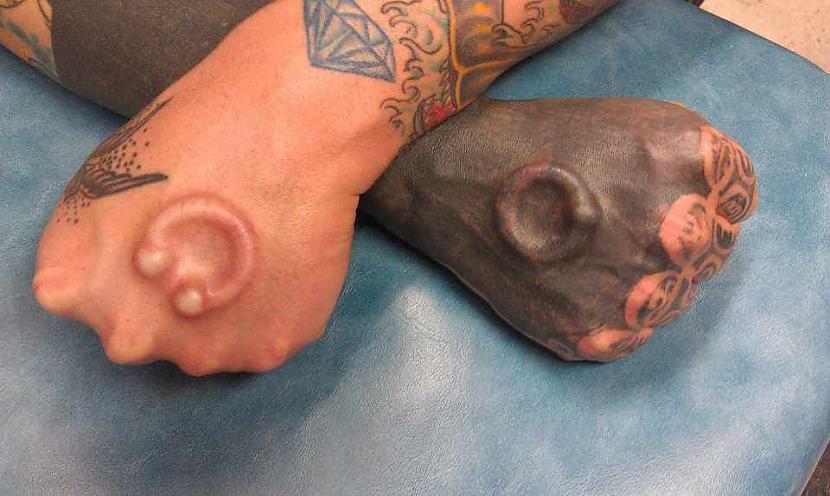 MakroDermālie Ievieto... Autors: Nilsons15 Body Modifications - Ķermeņa modifikācijas?! (1. daļa)