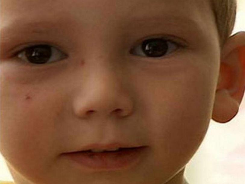 Puisēns kurscaron... Autors: Lestets 10 cilvēki ar neticamām diagnozēm