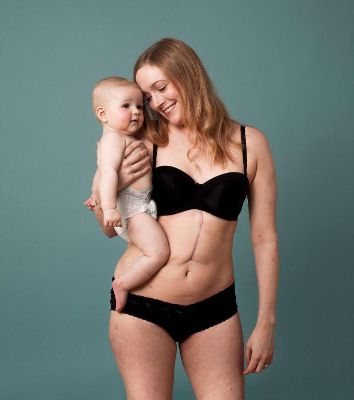 Fotogrāfijā redzama Luīze 29... Autors: matilde Jaunā «Mothercare» veikala reklāmas kampaņa izceļ sieviešu pēcdzemdību augumus