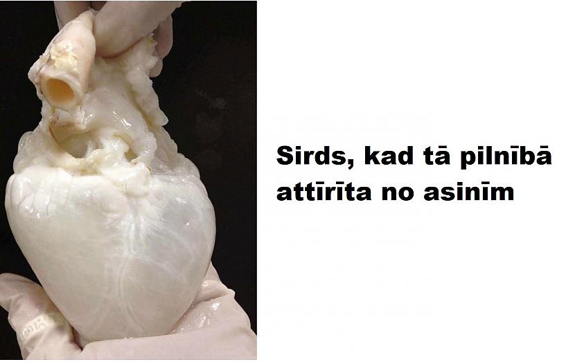 Autors: The Diāna 15 izglītojoši attēli par cilvēka ķermeni