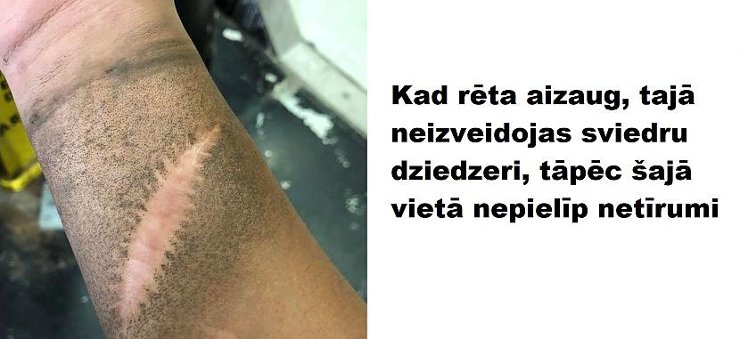 Autors: The Diāna 15 izglītojoši attēli par cilvēka ķermeni