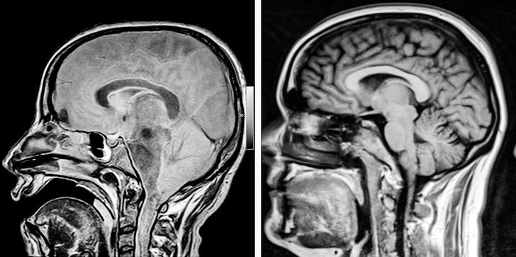 Tā izskatās normālas... Autors: Lestets 15 rentgenuzņēmumi, kas atklās par ķermeni vairāk nekā anatomijas grāmatas