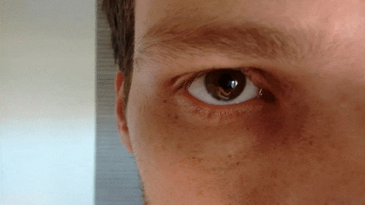 nbspStress var izraisīt acu... Autors: Lestets 14 cilvēku refleksi, kas mūs pārsteidz un apkauno